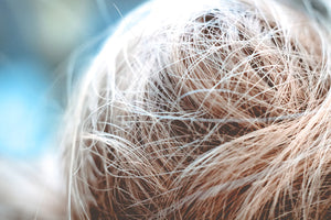 Effective Minoxidil and TRIOXIDIL Treatments for Thinning Hair