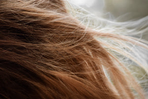 DHT and Hair Loss The Connection You Need to Know