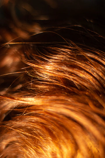 Explore the Future Trends in Hair Loss Treatments