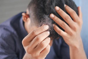 Effective Minoxidil Solutions for Men