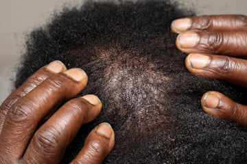 Essential Scalp Tools to Promote Hair Growth and Health